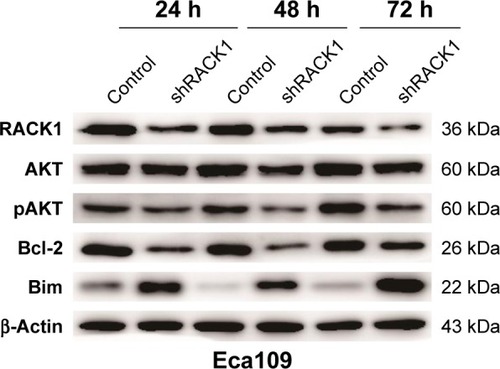 Figure 5 The effects of downregulating RACK1 on the activation of AKT and expression of Bcl-2 and Bim.