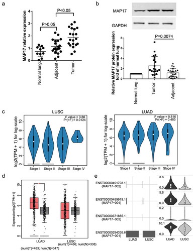 Figure 1. The expression of MAP17 was upregulated in NSCLC tissues. (a) The relative expression of MAP17 mRNA was examined in tumor specimens (n = 20), adjacent specimens (n = 20) and normal lung specimens (n = 10) using the RT-qPCR assay method. Every bar represents mean±SD in triplicate. (b) The expression of MAP17 protein was analyzed in tumor specimens (n = 20), adjacent specimens (n = 20) and normal lung specimens (n = 10) after performing a western blot assay. Every bar represents mean±SD in triplicate. (c) The stage plot indicates the association between MAP17 expression and LUSC (lung squamous carcinoma) and LUAD (lung adenocarcinoma) produced by the GEPIA 2 algorithm. (d) The box plot shows the expression of MAP17 in LUAD and LUSC produced by the GEPIA 2 algorithm. (e) The abundance of three isoforms of MAP17 in LUAD and LUSC was MAP17-001, according to the GEPIA 2 algorithm