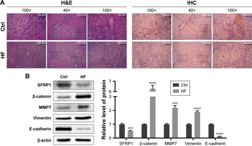 Figure 5 Wnt/β-catenin signaling was activated in HCC metastasis of obesity in vivo.
