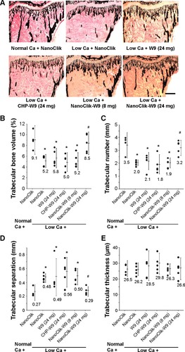 Figure 4 Mineralized tissue in cancellous region of tibial metaphysis.Notes: (A) Photomicrographs of undecalcified sagittal sections (5 μM) of the proximal tibiae with von Kossa staining and counterstained using a modified van Gieson method. The scale bar represents 500 μm. The area of mineralized tissue is shown in black. (B) Trabecular bone volume, (C) trabecular number, (D) trabecular separation, and (E) trabecular thickness. Data are shown as the mean ± standard deviation, with n=5 for each experimental group. *P<0.05 versus normal Ca + NanoClik; #P<0.05, versus low Ca + NanoClik.Abbreviations: BMD, bone mineral density; Ca, calcium; CHP, cholesterol-bearing pullulan; Normal Ca + NanoClik (n=5), vehicle (NanoClik nanoparticle)-injected mice fed a normal calcium diet; low Ca + NanoClik (n=5), vehicle (NanoClik nanoparticle)-injected mice fed a low calcium diet; low Ca + W9 (24 mg, n=5), W9 (24 mg/kg/day) was injected into mice fed a low calcium diet; low Ca + CHP-W9 (24 mg, n=5), W9 (24 mg/kg/day) incorporated in CHP nanogels was injected into mice fed a low calcium diet; low Ca + NanoClik-W9 (8 mg, n=5), W9 (8 mg/kg/day) incorporated in NanoClik nanoparticles was injected into mice fed a low calcium diet; low Ca + NanoClik-W9 (24 mg, n=5), W9 (24 mg/kg/day) incorporated in NanoClik nanoparticles was injected into mice fed a low calcium diet.