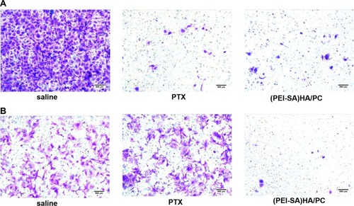 Figure 4 The invasiveness of SKOV3 and SKOV3-TR30 cells. (A) Representative photomicrographs of invasion with saline, PTX and (PEI-SA)HA/PC in SKOV3. (B) Representative photomicrographs of invasion with saline, PTX and (PEI-SA)HA/PC in SKOV3-TR30. Results are combined data from five experiments with different cell preparations. In SKOV3, both PTX and (PEI-SA) HA/PC significantly inhibited cell migration (P <0.001), which was significantly different from saline. In SKOV3-TR30, (PEI-SA) HA/PC significantly inhibited cell migration, but there was no significant difference between PTX and normal saline (P>0.05).