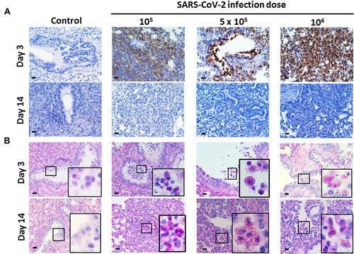 Figure 2 SARS-CoV-2 nucleoprotein expression and mucosal mucus levels in SARS-CoV-2-infected Syrian hamsters following different challenge doses. Hamsters aged 6 to 8 weeks (n=5) were infected with 105, 5×105, and 106 TCID50 of SARS-CoV-2 on day 0. (A) On days 3 and 14, samples of lung tissue were dissected, fixed in formalin and embedded in paraffin using routine methods, and the sections were then stained with anti-SARS-CoV nucleoprotein antibody. (B) PAS staining was performed on the same paraffin-embedded sections. The small box frame in each panel shows the macrophages that scavenged the extra mucus near the trachea. The large box frame shows an enlargement of macrophage phagocytosis. Scale bar for the 100× panels = 200 µm, for the 400× panels = 20 µm.