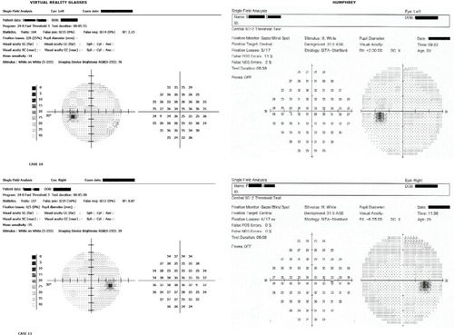 Figure 13 Results, eye 10–12.