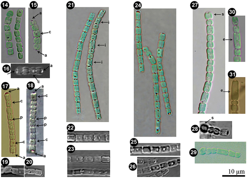 Figs 14–26. Details of polar and central aerotopes variability in Pseudanabaena pruinosa. Figs 14–26. P. pruinosa NMCCC 001. Figs 17–20. P. pruinosa NMCCC 002. Figs 21–23. P. pruinosa NMCCC 014. Figs 24–26. P. pruinosa NMCCC 013. Figs 27–29. Presence of swollen cells in P. pruinosa NMCCC 001 (Fig. 27), NMCCC 002 (Fig. 28) and NMCCC 013 (Fig. 29). Figs 30, 31. Irregular cell division and presence of elongated cells in P. pruinosa NMCCC 013 (Fig. 30) and NMCCC 002 (Fig. 31). Arrows in Figs 15–18 indicate apical cell aerotopes (designated with a), central aerotopes (c) and polar aerotopes (p). Arrows in Fig. 21 indicate cells with an irregular position of aerotopes. Arrows in Figs 27, 28 indicate swollen cells (s), and arrows in Figs 30, 31 indicate elongated cells (e). Scale bar = 10 µm.