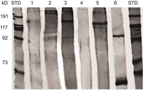 Figura 4. Electroforesis de proteínas extraídas de la piel y vejiga natatoria de peces utilizados en la clarificación de vino tinto. STD-marcadores de masa molecular, 1-vino tinto (control), 2-piel rocot, 3-vejiga natatoria rocot, 4-vejiga natatoria esturión, 5-piel curvina, 6- ovoalbúmina.Figure 4. Electrophoresis of proteins extracted from fish skin and swim bladder used for red wine clarification. STD-molecular mass markers, 1-red wine (control), 2-rocot skin, 3-rocot swim bladder, 4-sturgeon swim bladder, 5-curvina skin, 6-ovalbumin.