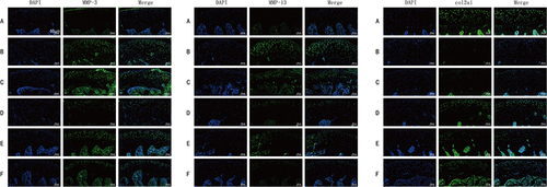 Figure 3 Effects of CGG on the expressions of ECM-related markers in knee cartilage tissues of KOA rats. Scale, 50µm. Protein expression levels of MMP-3 (left), MMP-13 (middle), and Col2al (right) in knee cartilage of KOA rats in each group. Notes: Group A, the blank group; Group B, the model control group; Group C, the CGG low-dose group; Group D, the CGG medium-dose group; Group E, the CGG high-dose group; Group F, the glucosamine hydrochloride group. CGG, Chonggu Granules.