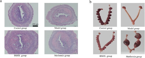 Figure 5. Uterine tissue morphology and pregnancy in rats of four groups. a: Rat endometrial tissue (HE staining). b: Pregnancy loci of rats.