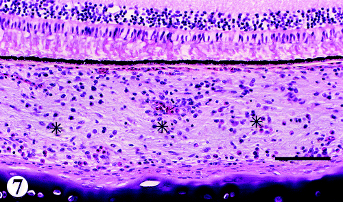 Figure 7. Choroid (*) of the eye from a 47-day-old broiler chicken infected with M. synoviae, in which there is infiltration of lymphocytes mixed with a few plasma cells. Haematoxylin and eosin, bar=100 μm.