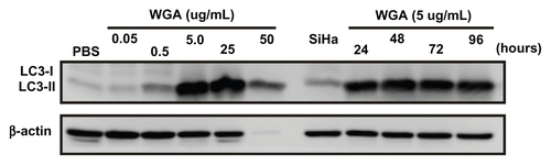 Figure S8 Autophagic cell death was induced by the nuclear pore complex inhibitor, wheat germ agglutinin (WGA), in SiHa cells. The autophagic marker, LC3- II, was probed by Western blotting of WGA given at different doses (0.05, 0.5, 5.0, 25, and 50 μg/mL) and time periods (24 to 96 hours). After treatment, autophagy increased significantly at 5.0, 25, and 50 μg/mL concentrations and was expressed from 24 hours to 96 hours.Abbreviations: LC3, microtubule-associated protein 1 light chain 3; PBS, phosphate-buffered saline.