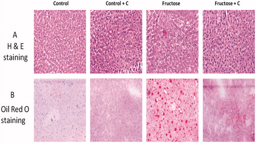 Figure 2. Effects of curcumin on liver fat accumulation in high-fructose-fed rats by (A) haematoxylin and eosin staining, (B) oil O red staining. Rats (n = 4) were fed with high-fructose diet and high-fructose diet + curcumin. Images were captured using phase contrast microscope Olympus BX43, Tokyo, Japan under 20× resolution. Fructose-fed rats showed marked fat accumulation. Fructose diet + curcumin prevented fat accumulation.