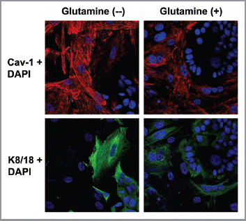 Figure 2 Glutamine induces the downregulation of Cav-1 in the fibroblast compartment. MCF7 cells and fibroblasts were cocultured for 5 d in media containing either high glutamine (right) or no glutamine (left). Cells were fixed and immunostained with antibodies against Cav-1 (red) and K8/18 (green). Nuclei were counter-stained with DAPI (blue). K8/18 staining is specific for MCF7 cells and Cav-1 is specific for fibroblasts since MCF7 cells lack Cav-1 expression. Note that Cav-1 expression is decreased in the fibroblast compartments of samples cultured with high glutamine, compared with no glutamine media. Original magnification, 40×.