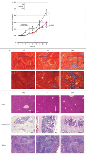 Figure 4. Treatment with rTRAIL variants lead to remission of Colo357 xenografts. (A) Immune-deficient mice were injected with5 × 106 Colo357 cells. After 10 d ( = day 0 of treatment regimen) 5 mg/kg rTRAILDR4 (green triangles; n = 3) were injected intraperitoneally. Treatments were repeated daily over 10 d. Animals in 2 additional groups received the same schedule with rTRAILwt (red squares; n = 3) and PBS (gray diamonds; n = 3), respectively. The tumor growth was followed over 23 d in total and the values are depicted in the graph. (B) Trichrome staining of tumor sections from mice treated with PBS, rTRAILwt and rTRAILDR4. (C) H&E staining of liver, bone marrow and spleen sections from mice treated with PBS, rTRAILwt and rTRAILDR4, respectively.