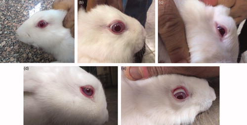 Figure 5. In vivo eye irritancy study showing photos of the eyes of the rabbits (a) control; (b) after 1 h (single insult challenge); (c) after 24 h (single insult challenge); (d) after 1 h (repeated insult challenge); (e) after 24 h (repeated insult challenge), from instilling the medicated spanlastics (F5).