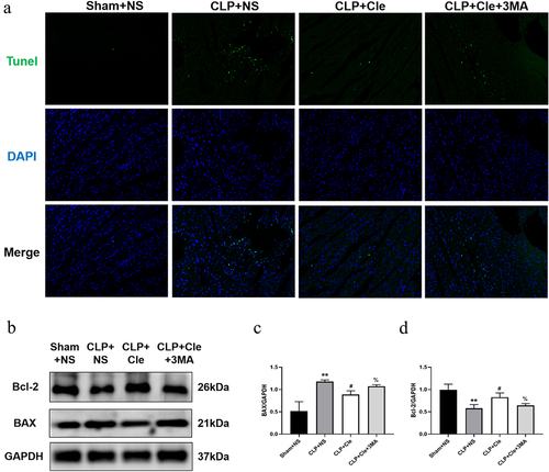 Figure 5. Clemastine mitigates myocardial apoptosis via promotion of autophagy. (a) Representative images depicting TUNEL-positive nuclei from four rat groups (200X); (b) Representative gel blots depicting the levels of BAX and Bcl-2; (c) BAX/GAPDH levels and (d) Bcl-2/GAPDH levels (n = 3). **P < 0.01 vs Sham+NS, #P < 0.05 vs CLP+NS, %P < 0.05 vs CLP+Cle.