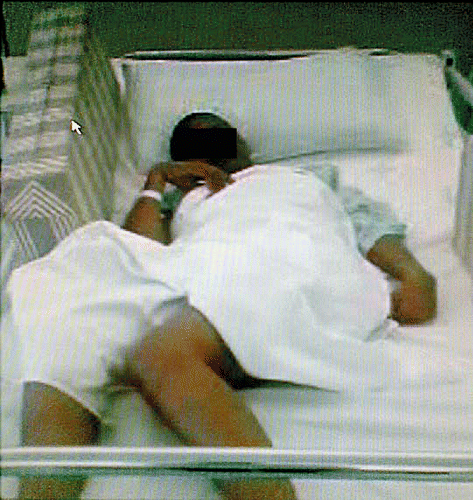 Figure 1: Patient was quadrispastic and bedbound.