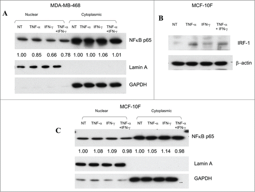 Figure 6. p65 protein expression is decreased in the nuclear fraction of the human breast cancer cell line MDA-MB-468. (A) The human breast cancer cells, MDA-MB-468, were either not treated or cultured with TNF-α, IFN-γ, or the combination of TNF-α and IFN-γ. 24 h post treatment, cells were harvested and nuclear and cytosolic fractions were isolated. (B) The spontaneously immortalized nonmalignant human breast cell line, MCF-10F, was either not treated or cultured with TNF-α, IFN-γ, or the combination of TNF-α and IFN-γ as described in Materials and Methods. 24 h post culture, cells were harvested and immunoblotting was performed as described in Materials and Methods. (C) The MCF-10F cells were either not treated or cultured with TNF-α, IFN-γ, or the combination of TNF-α and IFN-γ. 24 h post treatment, cells were harvested and nuclear and cytosolic fractions were isolated. Immunoblotting for NFκB p65 in nuclear and cytosolic fractions was performed as described in Materials and Methods.
