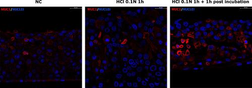 Figure 11 Immunofluorescence staining of MUC1 in untreated HO2E/12 tissues (NC) and HO2E/12 exposed to HCl 0.1N (pH 1.2) for 1h without (series HCl 0.1N 1h) or with 1h post incubation period (series HCl 0.1N 1h + 1h post incubation). Nuclei are stained in blue (DAPI). Magnification 63x. Scale bar = 30 μm. Representative images selected within triplicate series.