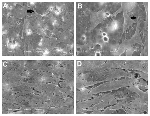 Figure 3 (A and B) Adhesion of MG63 osteoblast-like cells on day 1 on the Ag- nHA-nTiO2/PA66 membrane (SEM * 400)/(SEM * 1000). (C and D) Adhesion of MG63 osteoblast-like cells on day 5 day on the Ag-nHA-nTiO2/PA66 membrane (SEM * 400)/(SEM * 1000).Abbreviations: PA66, polyamide-66; SEM, scanning electronic microscope.