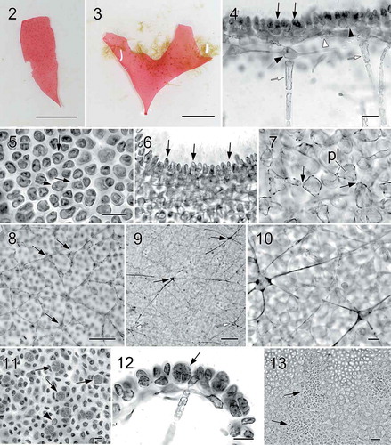 Figs 2–13. Halymenia ballesterosii Rodríguez-Prieto, S.-M. Lin, De Clerck & Huisman sp. nov. Thallus morphology, vegetative structure, sporophyte and male reproductive structure. Fig. 2. Holotype, a monoecious specimen with cystocarps scattered over fertile thallus surface (HGI-A 19484). Fig. 3. Isotype, a female gametophyte consisting of a bifurcating and apically eroded blade (HGI-A 19490). Fig. 4. Cross section of a young blade showing ovoid surface cells (black arrows), ovoid subcortical pit-connected cells (black arrowhead at right), third layer of stellate cells with short arms (white arrowhead), inner cortical cell with long arms (black arrowhead at left) and anticlinally arranged medullary filament (white arrows) (HGI-A 19490). Fig. 5. Surface view of a blade showing rounded to irregularly polygonal cortical cells with reticulate plastid (arrows) (HGI-A 19484). Fig. 6. Close up of a cross section of the blade showing ovoid and protruding surface cells (arrows) (HGI-A 19499). Fig. 7. Subsurface view of thallus blade showing subcortical ovoid to slightly stellate cells with very short arms. Note that cells are secondarily pit connected (arrows) and bear a reticulate plastid (pl) (HGI-A 19490). Fig. 8. Subsurface view of thallus blade showing the inner subcortical cells layer, composed of stellate cells with quite long arms (arrows) (HGI-A 11077). Fig. 9. Subsurface view of thallus blade showing the network of medullary stellate cells with long arms (arrows). Note that the network is composed both by darkly staining (black arrows) and non-darkly staining medullary cells (white arrows) (HGI-A 6552). Fig. 10. Detail of the medulla and medullary stellate cells of Fig. 9 (HGI-A 6552). Fig. 11. Subsurface view showing a tetrasporangial initial (arrowhead) and many scattered tetrasporangial initials that are divided once (arrows) (HGI-A 19488). Fig. 12. Cross section through a tetrasporangial sorus showing cruciately divided tetrasporangium (arrow) (HGI-A 19498). Fig. 13. Surface view of spermatangial sori (arrows) (HGI-A 19477). Haematoxylin (Figs 4, 5); Aniline blue (Figs 6–12); Not stained (Fig. 13). Scale bars: Figs 2, 3 = 1 cm; Figs 4, 5, 7, 12, 13 = 20 µm; Figs 6, 10, 11 = 10 µm; Fig. 8 = 50 µm; Fig. 9 = 100 µm