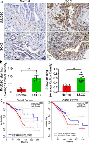 Figure 7. Jmjd2c and SOX2 expression are closely related to the development and prognosis of LSCC. (a) Immunochemistry results showed the protein expressions of Jmjd2c and SOX2 in normal and LSCC tissues. (b) The quantitative analysis of Jmjd2c and SOX2 expressions in A. (c) Overall survival of Jmjd2c and SOX2 in LSCC based on Kaplan Meier-plotter. The patients were stratified into high-level group and low-level group according to different expression ratio. The data are represented as means ± SD, n ≥ 100，***p < 0.001.