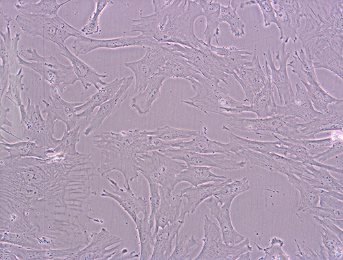 Figure 1 Mesenchymal stem cells from a 4-day culture bright field microscopy (BF), 200× magnification, using Xcellence RT system with an IX81 inverted microscope (Olympus).