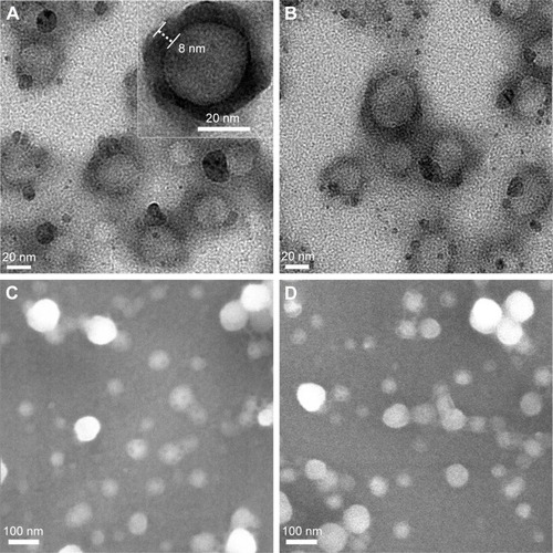 Figure 1 TEM (top panel) and SEM (bottom panel) images of DOX/FA-Z-NCs (A, C) and DOX/Z-NCs (B, D).Note: The inset in (A) shows a typical example of the hollow nanocapsule (FA-Z-NC) in the magnified view.Abbreviations: DOX, doxorubicin; FA, folic acid; NCs, nanocapsules; SEM, scanning electron microscopy; TEM, transmission electron microscopy.