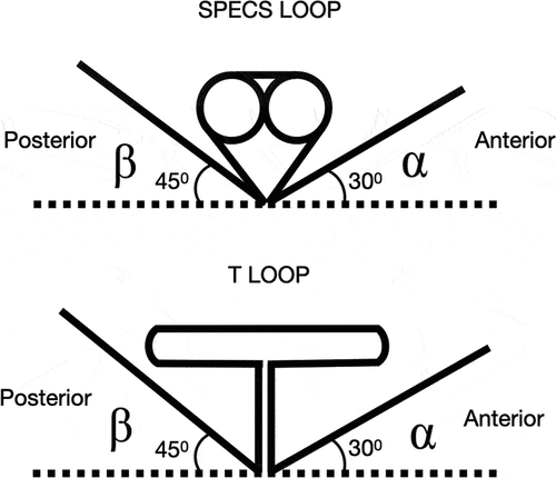 Figure 3. Specs loop and T loop with preactivation bends.