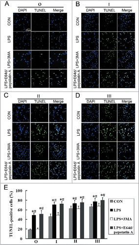 Figure 8. Inhibition of the formation of autophagosomes may reduce LPS-induced apoptosis in AMs at different stages of silicosis. (A–D) Representative photographs of TUNEL staining in AMs treated without or with 3MA (7.5 mM), or cotreated with or without E64d (10 μg/ml) and pepstatin A (10 μg/ml), and stimulated with LPS (150 μg/ml) for 24 h. Scale bar: 30 μm. (E) Ratios of TUNEL-positive apoptotic cells. 6 fields were analyzed for each sample from each cell population. The bar graph shows the percentage of TUNEL-positive nuclei relative to DAPI-positive total nuclei. n = 5 for observer, stage I, II and III groups. *, P < 0.05 vs. CON; #, P < 0.05 vs. LPS+3MA.