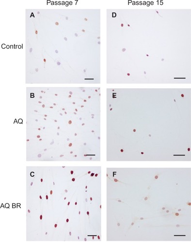 Figure 3 Immunohistochemical EnVision staining of fibroblast cell culture.