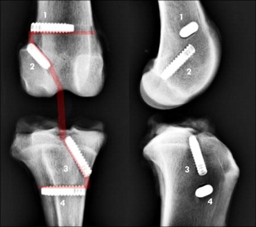 Figure 1. Cranial and lateral X Rays of implanted knees after traction: The UHMWPE prosthesis is fixed with 4 screws. 1: transverse femoral screw, 2: oblique femoral screw, 3: oblique tibial screw, 4: transverse tibial screw.