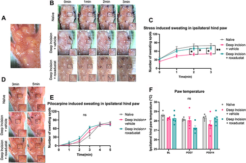 Figure 4 Perioperative PIC using roxadustat mitigated surgery-induced local sweating impairments in the restraint stress-induced sweating assay, whereas no difference was observed in pilocarpine-induced sweating and paw temperature.