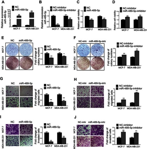 Figure 4 MiR-489-5p inhibits breast cancer cell proliferation, migration and invasion. (A) Expression levels of miR-489-5p were determined by qRT-PCR in MCF-7 and MDA-MB-231 cells transfected with miR-489-5p mimics or negative control scrambled oligonucleotides (NC). (B) Expression levels of miR-489-5p were determined by qRT-PCR in MCF-7 and MDA-MB-231 cells transfected with miR-489-5p inhibitor or negative control scrambled oligonucleotides (NC inhibitor). (C–D) Cell viabilities of respective transfected MCF-7 and MDA-MB-231 cells were determined by MTT assay 5 days post-seeding. (E-F) Colony formation of transfected MCF-7 and MDA-MB-231 cells over a period of 10 days was determined. (G–J) Migration and invasion of transfected MCF-7 and MDA-MB-231 cells were determined by transwell assay. All data are present as mean ± SD from three independent experiments. *P<0.05; **P<0.01 (Student’s t-test).