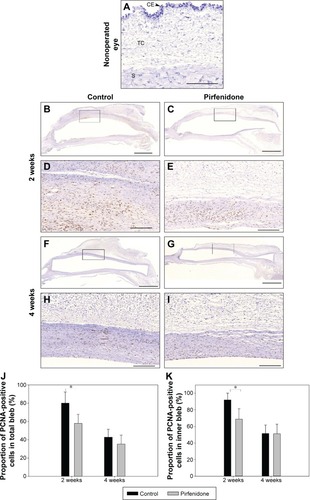 Figure 4 Immunohistochemical micrographs for cell division in the bleb.