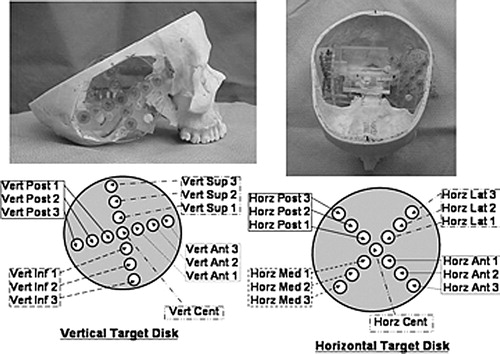 Figure 3. The experimental set-up for determining target registration error within the region of the temporal bone. Illustrated is one of the three skulls which has had the temporal bones removed and replaced with 2 discs, each holding 13 surgical targets arranged in a cross-hair pattern over the approximate centroid of the temporal bone. The left photograph shows the vertical disc while the right photograph shows the horizontal disc. The respective identification systems are shown in the schematics beneath the photographs. These identifiers are used in data reporting in Tables I, III and V.