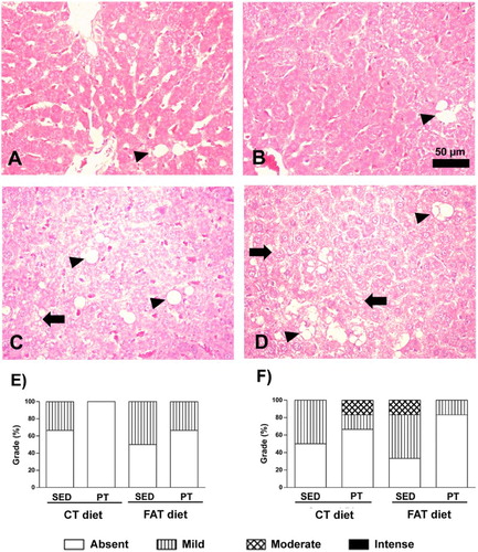 Figure 4. Photomicrographs of liver stained with hematoxylin and eosin (HE). Arrow indicates microvesicular steatosis, and arrowhead indicates macrovesicular steatosis. (A) Rat fed with a control (CT) diet and maintained sedentary (SED). (B) Rat submitted to a control (CT) diet and physical training (PT). (C) Rat submitted to a high-fat (FAT) diet and maintained sedentary (SED). (D) Rat submitted to a high-fat (FAT) diet and physical training (PT). Magnification 440×. Bar = 50 μ. Qualitative evaluation of macrovesicular steatosis (E) and microvesicular steatosis (F) in liver tissue, using a grade from absent to mild, moderate or intense.