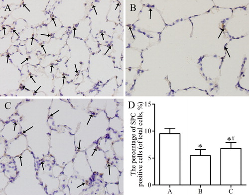 Figure 5. Immunohistochemical analysis of the expression of SPC in lung parenchyma from control group (A), emphysema group (B), and emphysema + SRT2104 group (C). The arrows indicate the SPC positive cells. Magnification, ×400. (D) The percentage of SPC positive cells in each group. Values are presented as mean ± SD (n = 15). *p < 0.05 vs. group A; #p < 0.05 vs. group B.