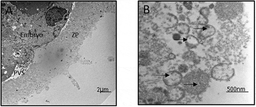 Figure 3. TEM images of a day 3 embryo labeled with 5nm immuno-gold antibodies against CD9. In A clusters of EVs are seen in the PVS, in the embryo under the PVS, and throughout the ZP (scattered black dots). Higher magnification of the ZP in B shows CD9 positive vesicles from A. Immuno-gold labeling is highlighted with arrows.