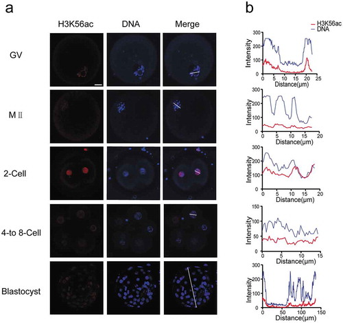 Figure 2. Dynamics of H3K56ac during human preimplantation development. (a) Immunofluorescence of H3K56ac in preimplantation embryos. Oocytes and frozen-thawed embryos were fixed and stained with H3K56ac antibody (Red). DNA was stained by Hoechst as shown in blue. Blastocysts were shown as full projections of Z-sections taken every 8 μm on a confocal microscope. (b) Fluorescence intensity profiles of H3K56ac and DNA of all stages of embryos. Lines were drawn on the images of nuclei to quantify intensities for H3K56ac (red) and DNA (blue) along the lines. Scale bar, 20 μm.