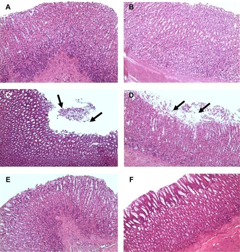 Figure 5 Photomicrographs.Notes: (A, B) Stomachs of the control group (group 1) and blank nanoemulsion-treated group (group 2), showing normal stomach architecture (H&E, 200×); (C, D) stomachs of the aspirin-treated group (group 3), showing massive sloughing of the superficial parts of gastric glands (arrows) (H&E, 200×). (D) shows more damaged epithelium than in (C) and the sloughing tissue occurs at a larger area. (E, F) stomachs of the aspirin nanoemulsion-treated group (group 4), showing normal gastric gland architecture (H&E, 200×). (F) Shows more healthy and intact gastric epithelium with no inflammatory cells infiltration than in (E).Abbreviation: H&E, hematoxylin and eosin.