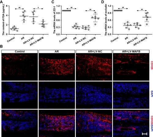 Figure 6 MAFB protected the epithelial barrier integrity of AR mouse induced by OVA. Mice were intraperitoneally injected with 25 μg OVA and 1 mg aluminum hydroxide gel on days 0, 7, and 14, followed by a nostril challenge with 500 μg OVA from day 21 to day 27. Selected groups of mice were injected with 1×107 TU/mL LV-MAFB into the tail vein of mice 48 h before the nostril challenge on day 19. (A) The serum content of FDA. (B) The expression of CDH26 evaluated by immunofluorescence staining (×400). Scale bar = 50 μm. (C and D) The mRNA levels of ZO-1 and occluding in the nasal mucosa of AR mice. #p<0.05, ##p<0.01.