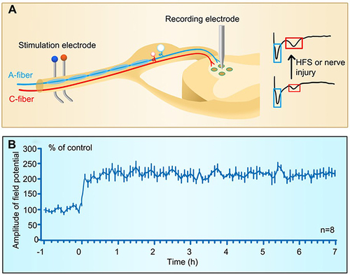 Figure 4 Long-term potentiation at C-fiber synapses in spinal dorsal horn. (A) Experimental setup for recording LTP of C-fiber evoked field potentials induced by electrical stimulation or injury of peripheral nerves. A-fiber and A-fiber-evoked field potentials are marked in blue and C-fiber and C-fiber-evoked field potentials in red. (B) The time course of the spinal LTP induced by high frequency stimulation (100 Hz, 100 pulses is given in 4 trains of 1-s duration at 10-s intervals, at the intensity sufficient to activate C-fibers) delivered to peripheral nerve. (B) Reprinted with permission from Liu XG, Sandkuhler J. Characterization of long-term potentiation of C-fiber-evoked potentials in spinal dorsal horn of adult rat: essential role of NK1 and NK2 receptors. J Neurophysiol. 1997;78(4):1973–1982.Citation200