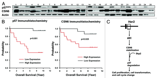 Figure 6. Expression levels of CSN6 and p57 in breast cancer samples and their correlations with survival. (A) A large percentage of breast cancer samples have high CSN6 and low p57. Cell lysates from 25 primary human breast cancer samples were immunoblotted with indicated antibodies. (B) Kaplan-Meier analysis showed that high expression of CSN6 and low expression of p57 were associated with poor overall survival. The expression levels of CSN6 and p57 were investigated by immunohistochemical staining, and were correlated with the overall survival rate. (C) Model of how CSN6-mediated p57 degradation affects cell proliferation, cell cycle progression and cell transformation.