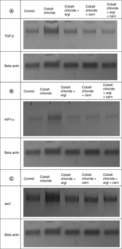 Figure 8. (A–C) Representative immunoblots (Western blot analysis) of cardiac TGF-β, HIF1-α, and AKT in control and different treated groups.
