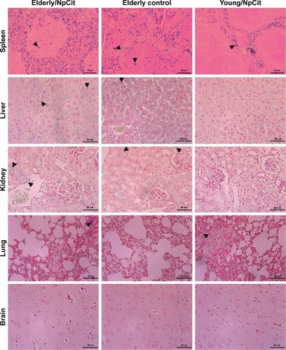 Figure 4 Effects of NpCit on iron distribution of elderly (left column) and young (right column) animals. Organ sections of elderly control animals without treatment are presented in the central column. Histological sections of spleen, liver, kidneys, lungs, and brain were submitted to Perls’ blue staining. Arrows indicate blue positive aggregates which are more evident in the spleen. Micrographs are illustrative and were taken at day 7 and day 28 of treatment, respectively, from elderly and young animals. Scale bar =50 µm.Abbreviation: NpCit, nanoparticles coated with citrate.