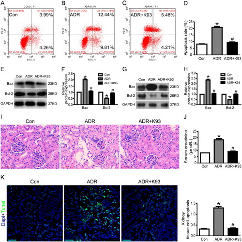 Figure 2. Inhibition of CaMKII activity ameliorated ADR-induced RTEC apoptosis and kidney injury. (A–D) Culture RTECs were stained with Annexin V/PI for flow cytometry analysis. Cell apoptosis rate increased significantly in ADR-injured RTECs compared with that in the controls (p < 0.01). However, the cell apoptosis rate was ameliorated by using K93 (CaMKII activity inhibitor) in ADR-injured RTECs (p < 0.01). (E–F) Western blotting showed that Bax protein expression increased while Bcl-2 decreased in ADR-injured RTECs (p < 0.01). However, inhibition of CaMKII activity via K93 prevented these changes (p < 0.01). (G–H) Bax protein expression increased while Bcl-2 decreased in kidney tissue cells of ADR-treated mice (p < 0.01). However, inhibition of CaMKII activity via K93 prevented these changes (p < 0.01). (I) HE staining of ADR-treated mice showing damaged epithelial cells in renal tubules. Inhibition of CaMKII activity via K93 ameliorated this damage. Magnification ×400, scale bar = 50 μm. (J) Serum creatinine levels increased in ADR-treated mice (p < 0.01). However, serum creatinine level was almost normal after inhibiting CaMKII activity using K93 in ADR-treated mice (p < 0.01). (K) Kidney tissue cell apoptosis was examined via the TUNEL assay. Apoptotic cells (sky blue-stained) increased in ADR-treated mice, but K93 treatment prevented apoptosis. Magnification ×200, scale bar = 50 μm. Mean ± SE, n = 6. *p < 0.01 vs. Con. #p < 0.01 vs. ADR. There was no statistically significant difference between the Con and ADR + K93 groups.