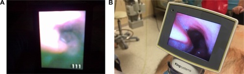 Figure 2 Images obtained from the same patient with two devices.