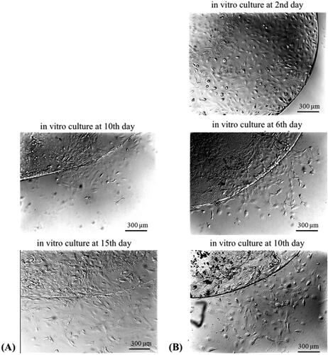 Figure 1. Primary LECs cultures isolated from anterior lens capsule from type 2 diabetic cataract (A) and from age-related cataract (B).