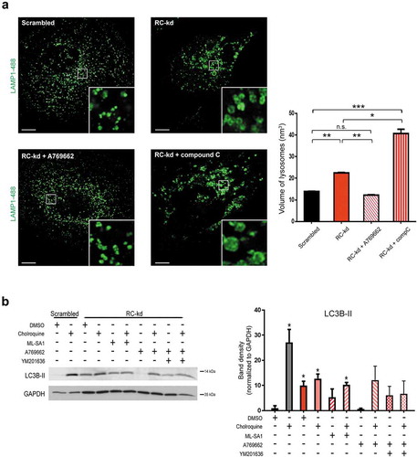 Figure 6. AMPK activation rescues lysosomal size. (a) Lysosomal enlargement in RC-kd cells is rescued by AMPK reactivation. Representative Airyscan confocal equatorial plane images of scrambled or RC-kd HeLa cells, treated with A769662 or compound C (DMSO as vehicle control), and stained with anti-LAMP1 antibody (secondary conjugated with Alexa Fluor 488 fluorophore). Scale bar: 3 μm. The measurement of the lysosomal volume across at least 40 cells obtained for each condition from 2 independent experiments, is plotted on the right panel as average±s.e.m.. ANOVA p-value *p < 0.05, **p < 0.005 and ***p < 0.001. (b) Reactivation of AMPK signaling in RC-kd restores autophagosome digestion. Western blot analysis of whole-cell extracts for LC3B in RC-kd and scrambled control HeLa cells, using GAPDH as loading control. Every condition was also subject to the treatment with the lysosomal inhibitor chloroquine, to assess the amount of autophagosomes that accumulate specifically due to lysosomal impairment. The band for LC3B-II, a marker of autophagosomal mass, is increased in RC-kds and rescued by activation of AMPK. This rescue is dependent on the activity of PIKFYVE (inhibited by YM201636). Column plot shows average±s.d. of 2 experiments. ANOVA p-value *p < 0.05 (against control condition in the absence of chloroquine, lane 1).