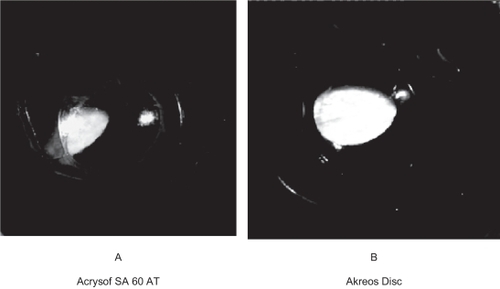 Figure 3 Gross photographs from behind in the rabbit model we studied (Miyake-Apple technique). A) Note the PCO developed in a case with Acrysof SA 60 AT. You can also note the fibrous strands behind the optic. B) Note the mild PCO developed in a case with Akreos Disc.