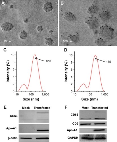Figure 2 Characterization of exosomes.Notes: (A, B) TEM micrographs of Apo-Exo before and after loading with miR-26a, respectively. (C, D) DLS assay corresponding to (A and B). (E) Western blots of 293T cells untransfected (mock) and transfected with pEGFP-CD63-Apo-A1 vector (transfected). (F) Western blots of exosomes obtained from culture supernatants of 293T cells that had been untreated (mock) and transfected with pEGFP-CD63-Apo-A1 vector (transfected; n=3).Abbreviations: Apo-Exo, Apo-A1-Exosomes; DLS, dynamic light scattering; TEM, transmission electron microscope.